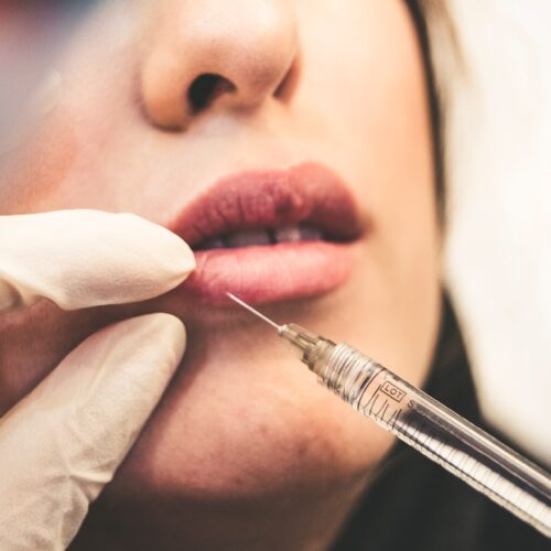 7 Common Botox Myths Debunked