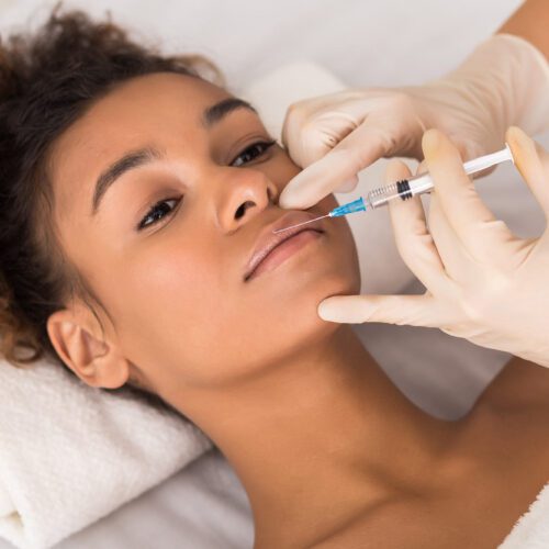 Filler Training FAQs