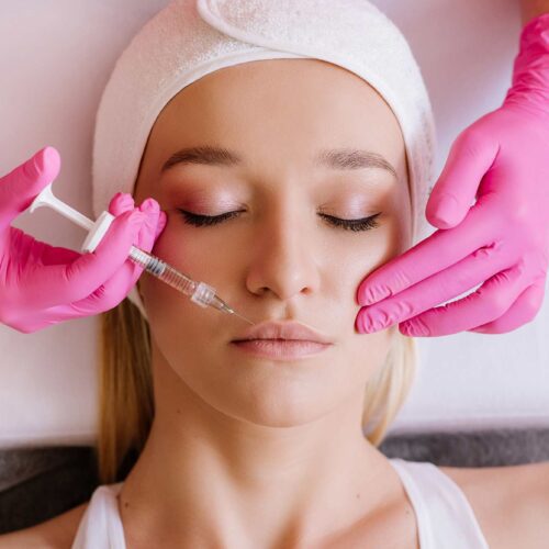 Lip Filler Swelling Stages and Complications